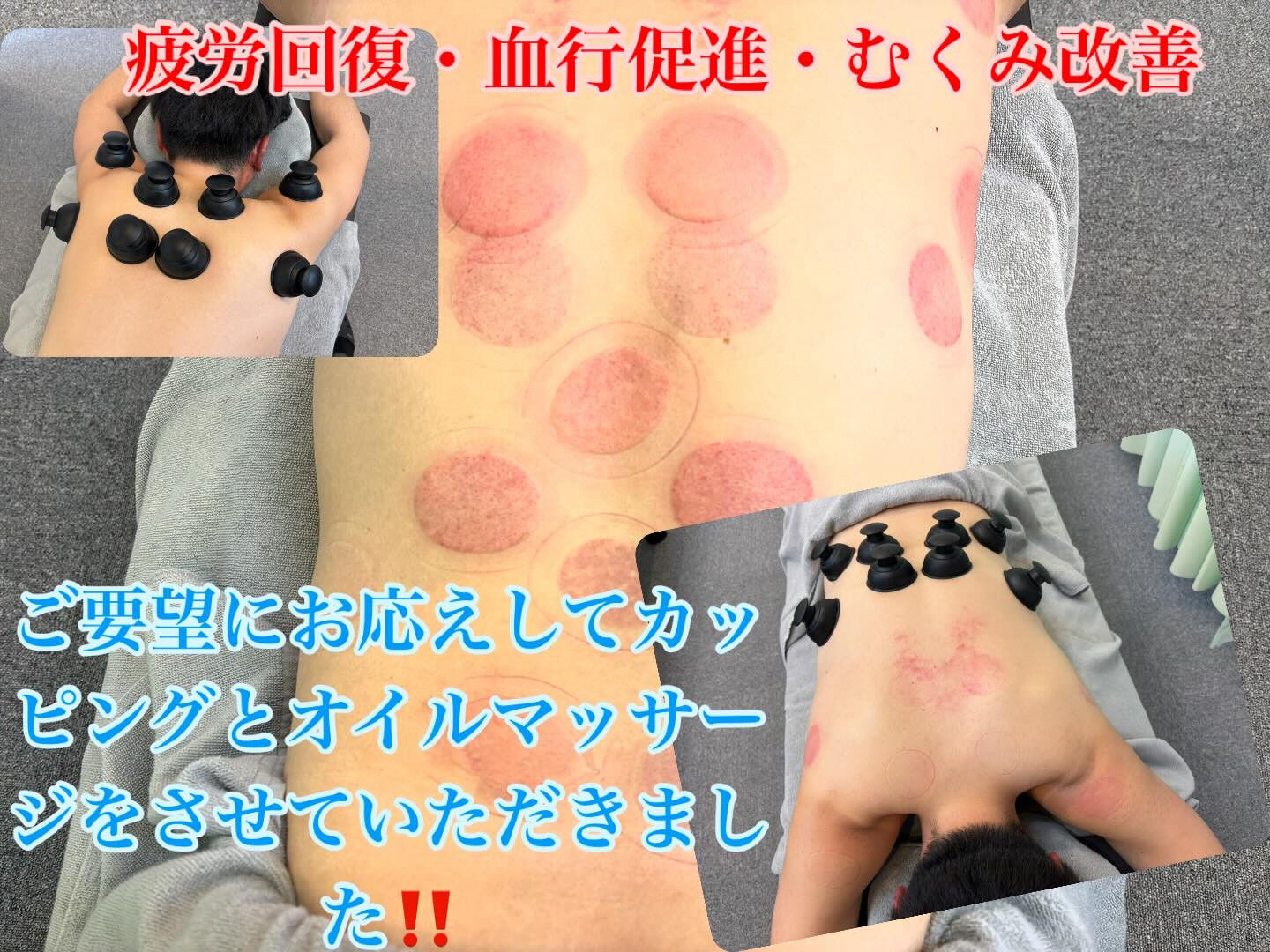 ⭐️カッピング・オイルマッサージ⭐️